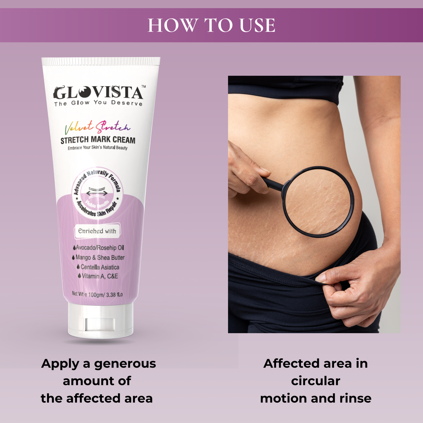 Velvet Stretch - Stretch Mark Cream 100gm